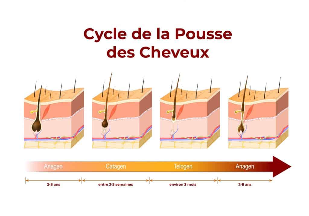 Perte de cheveux chez la femme : les causes et les remèdes