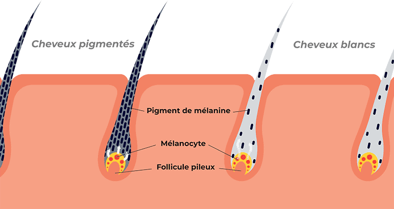 Quelle est la cause des cheveux blancs