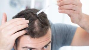 Soins du cuir chevelu d'un homme