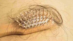 Chimiothérapie et cheveux : perte de cheveux