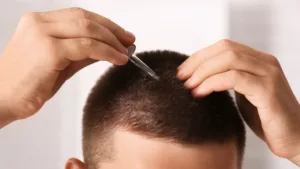 perte-de-cheveux-stress Applique-une-huile-pour-la-perte-de-cheveux-stress