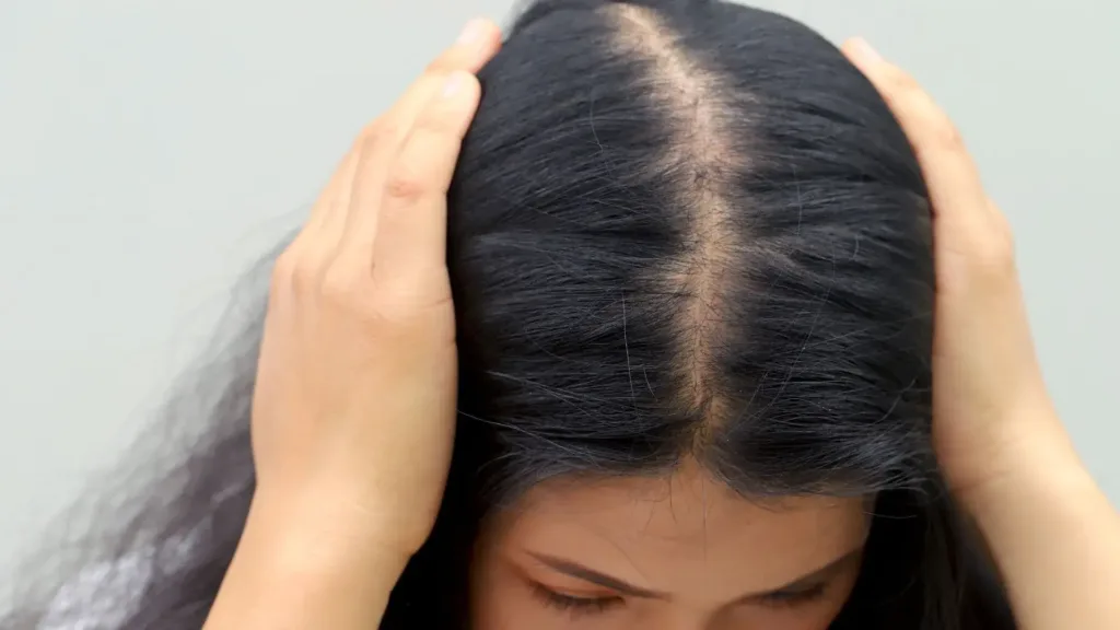 Cheveux et stress : chute de cehevux