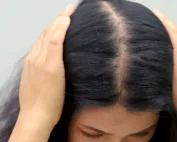 Cheveux et stress : chute de cehevux