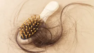 brosse à cheveux avec une poingnée de cheveux tombé