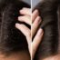 Pellicules sur cheveux avant après